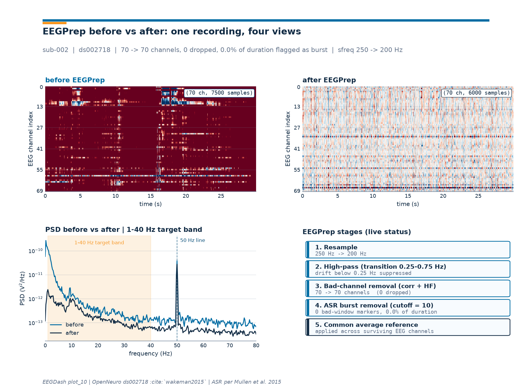 before EEGPrep, after EEGPrep, PSD before vs after | 1-40 Hz target band